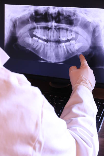 Best Emergency Dentist for Knocked-Out Tooth in USA